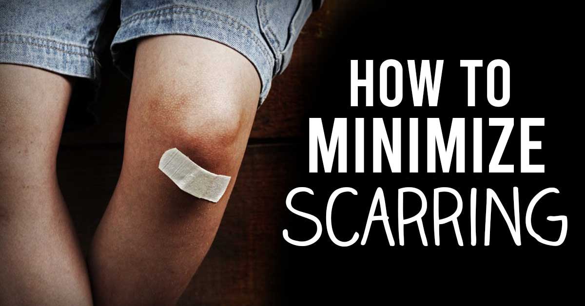 how to minimize scarring