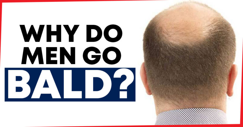 why-do-men-go-bald-williams-integracare-clinic