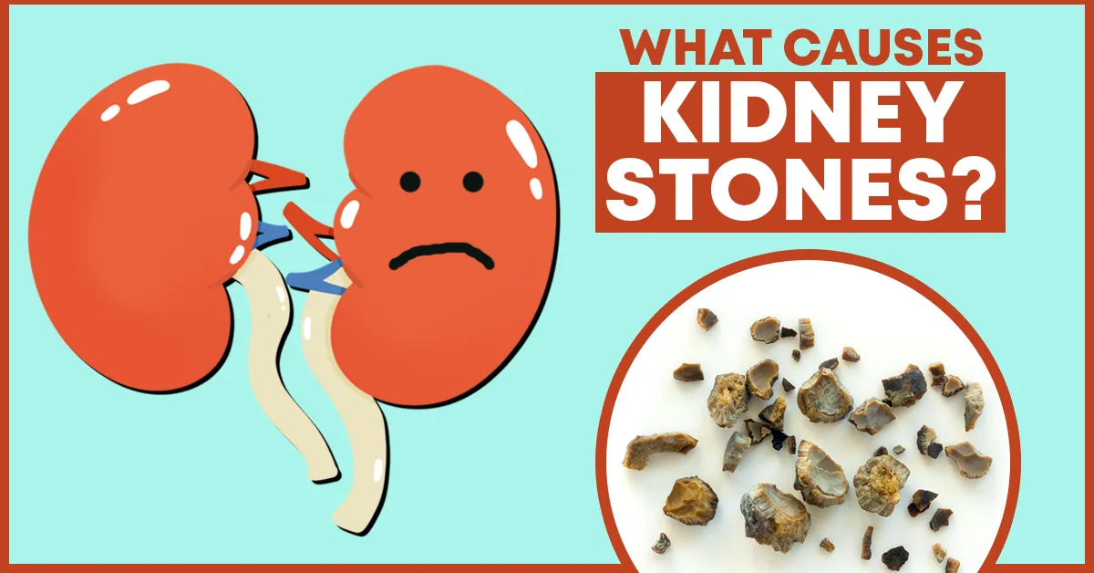 what causes kidney stones