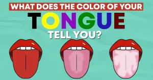 what does the color of your tongue mean