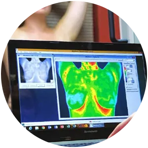 thermography breast exam